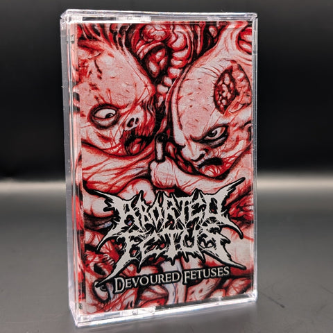 Aborted Fetus - Devoured Fetuses Tape