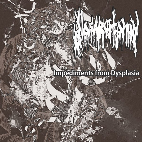 Glossectomy - Impediments from Dysplasia CD