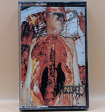 Disgorge - Chronic Corpora Infest Tape (1998 Dark Angel Records)[USED]