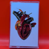 Carcass - Torn Arteries Tape