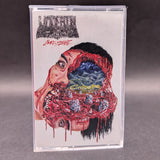 Undeath - More Insane Tape (2024 Prosthetic Records)[USED]