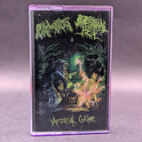 Pukewraith/Intestinal Hex - Medieval Gore Tape (2022 Gurgling Gore)[USED]