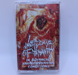 Last Days of Humanity - In Advanced Hemorrhaging Conditions Tape